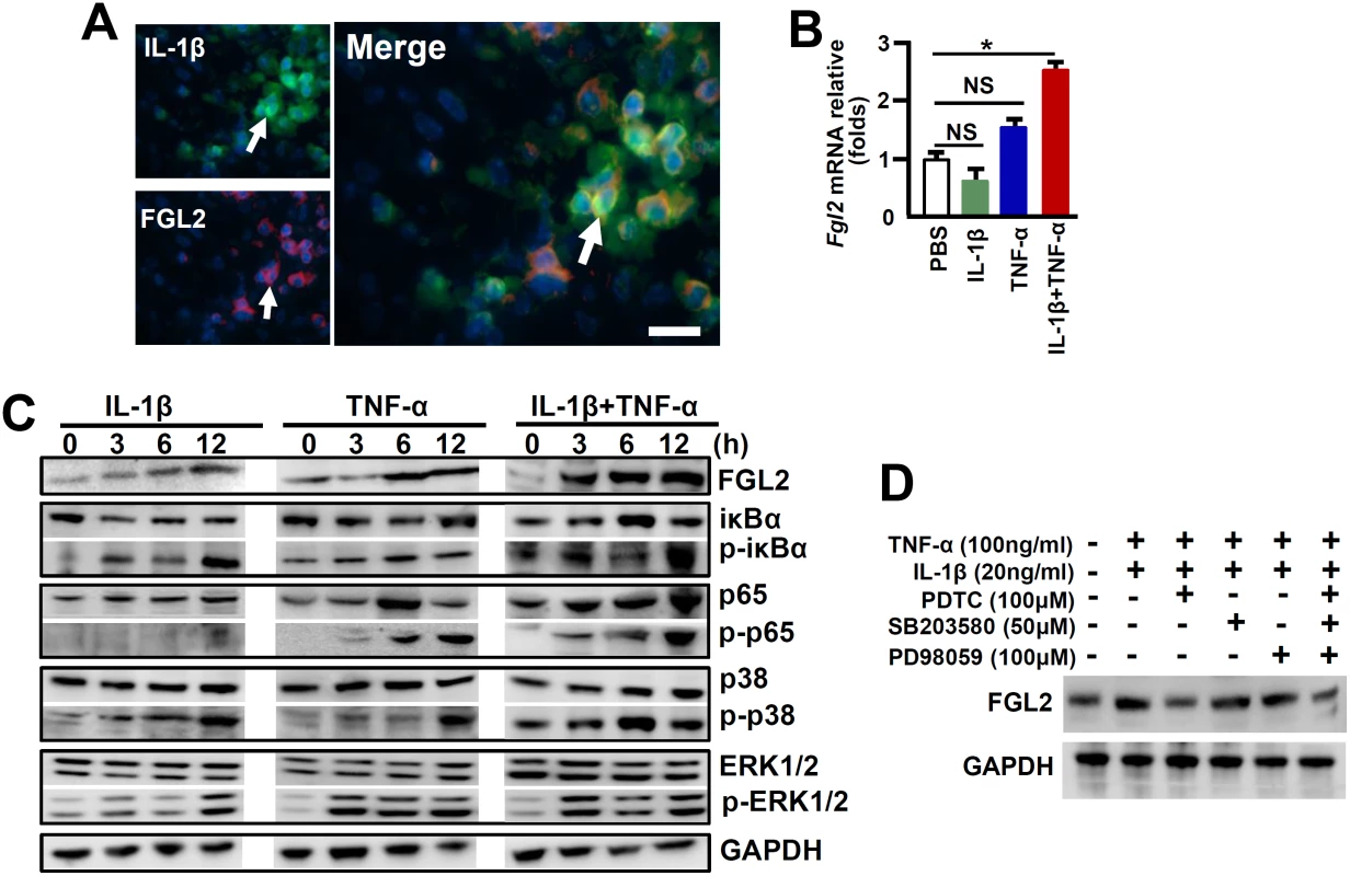 IL-1β synergistically acts with TNF-α to promote FGL2 overexpression through activation of NF-κB signaling.
