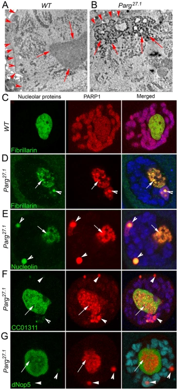 Mutating PARG disrupts nucleoli and reveals differential localization of nucleolar proteins.