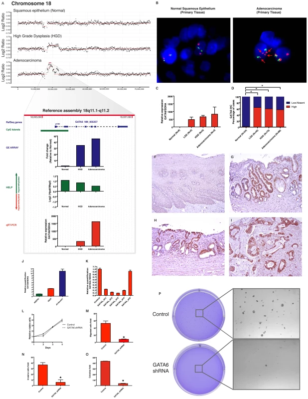 GATA6 is amplified and functions as an oncogene in esophageal adenocarcinoma.