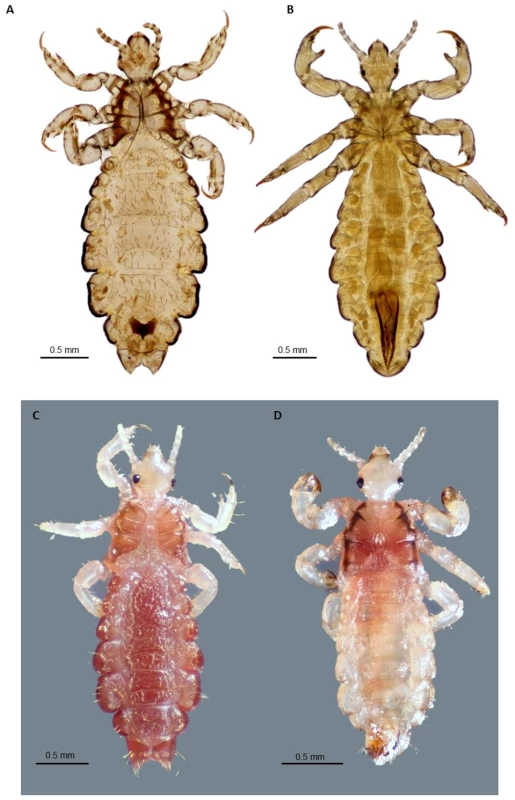 Adult body louse and head lice.