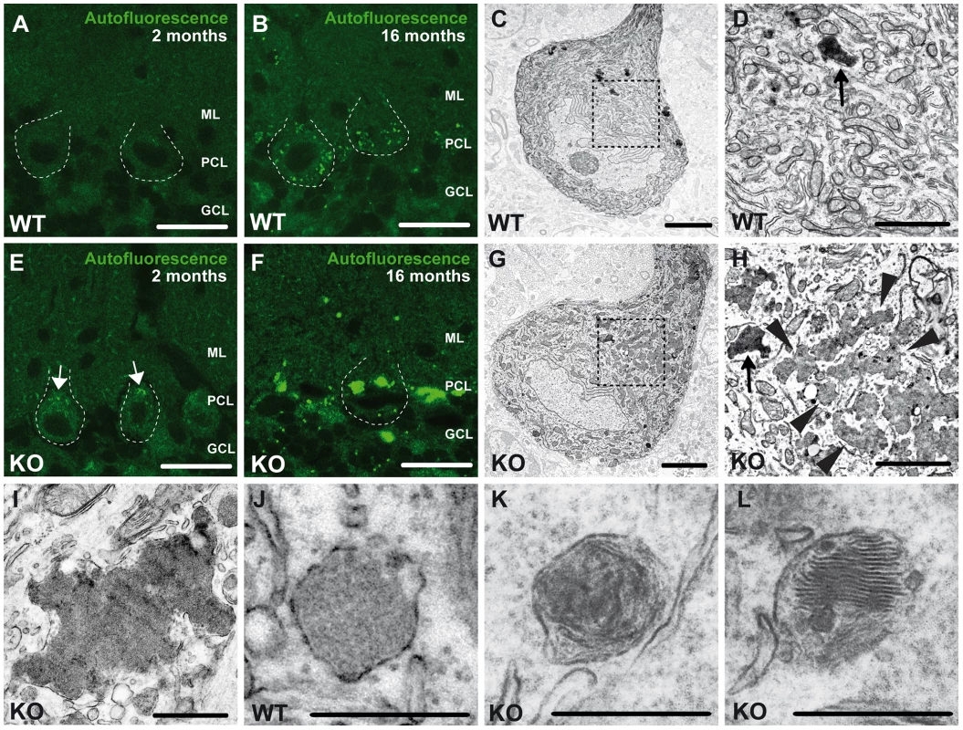 Accumulation of autofluorescent, electron-dense, membrane-enclosed material in knockout mice.