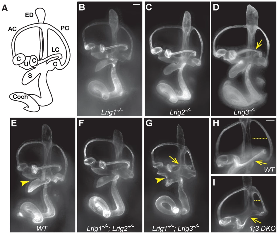 Lrig1 and Lrig3 act redundantly during inner ear morphogenesis.