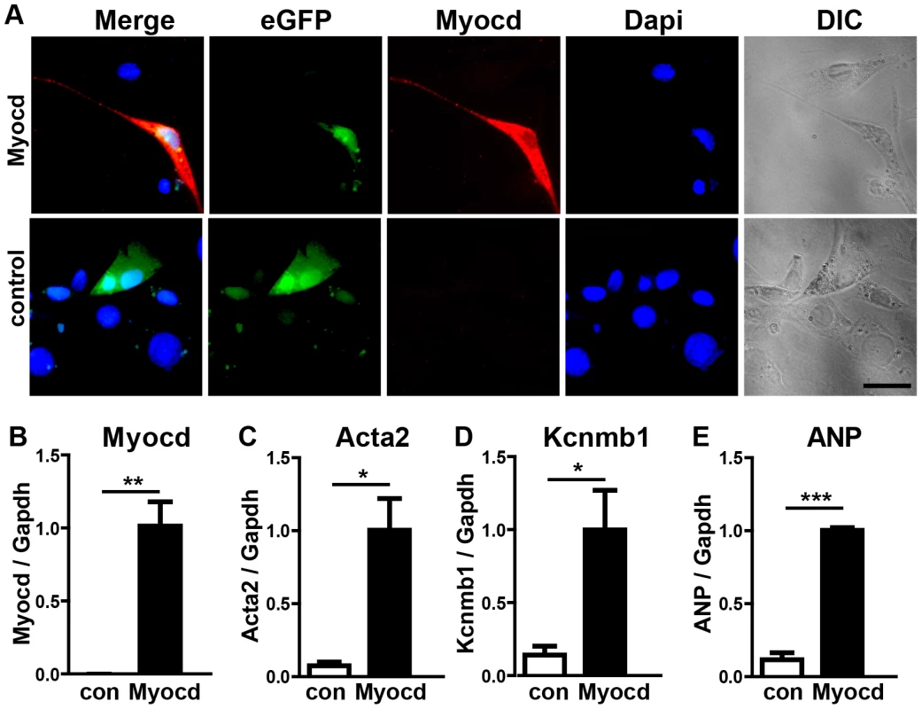 Expression of the miR-1 target myocardin induces smooth muscle cell-like morphology in NIH3T3 cells.