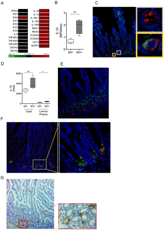 IL-1β production by Paneth cells precedes the IFN antiviral response in early SIV infection.