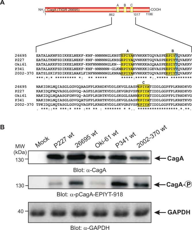 Sequence comparison of the three TPM sites in CagA proteins from different clinical <i>H. pylori</i> strains and specific detection of phosphorylated EPIYT-motif during co-culture.
