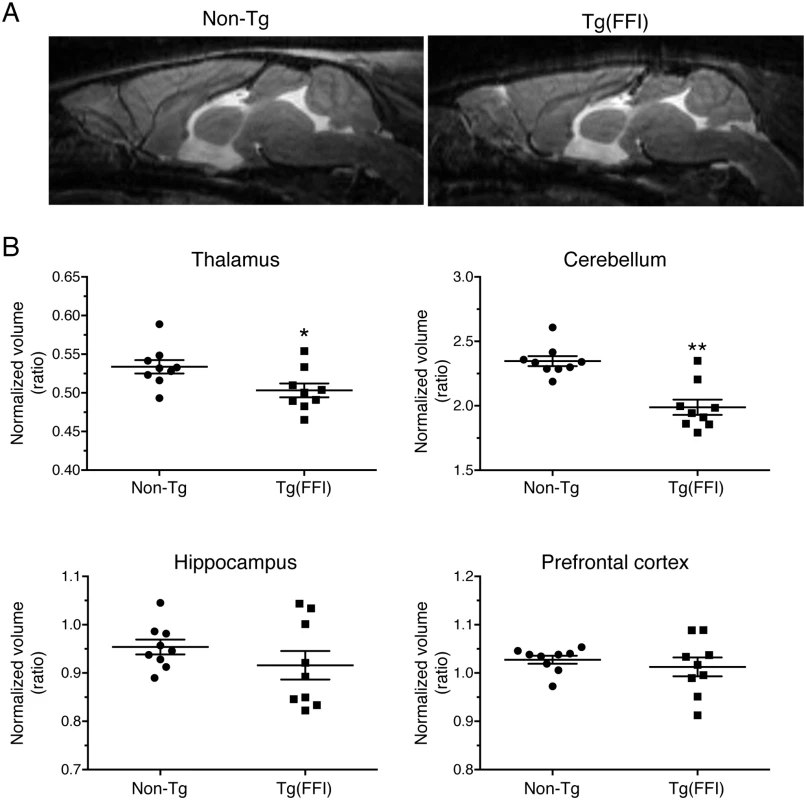 Tg(FFI) mice show thalamic and cerebellar atrophy.