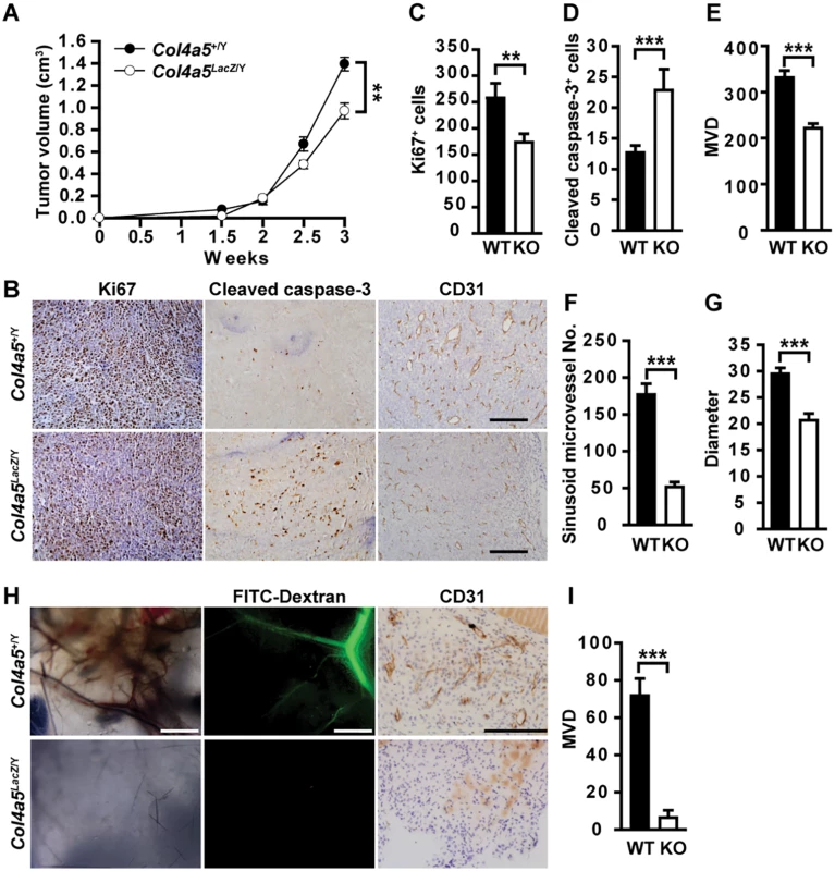 Stromal α5(IV) is required for tumor growth and tumor angiogenesis.