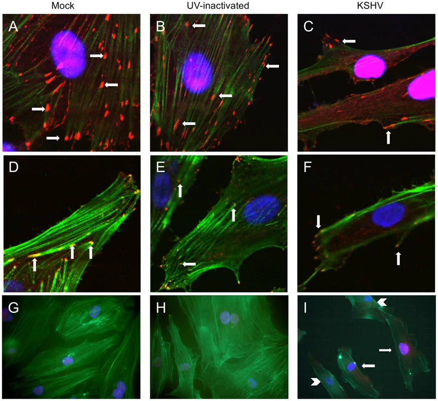 KSHV latent infection promotes turnover of focal adhesions and relocalization of integrin β3.