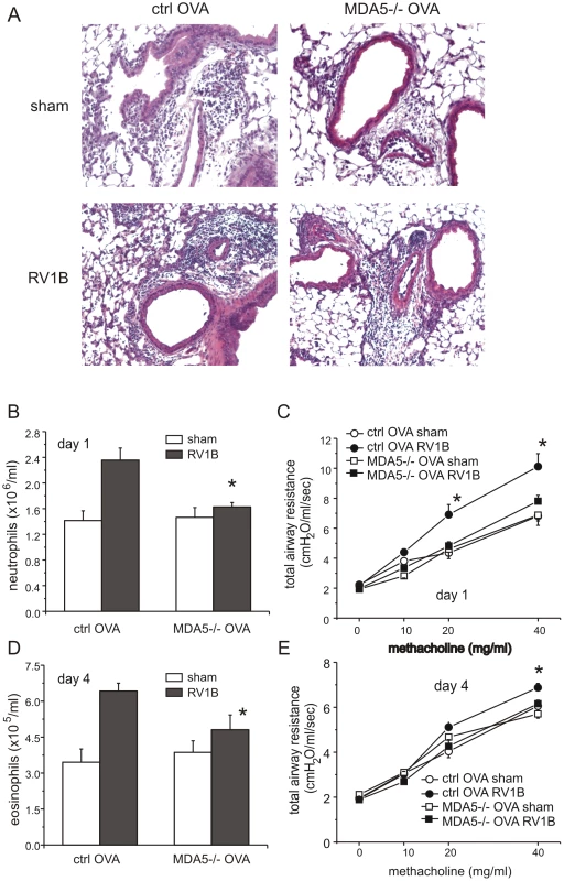 Lung inflammation in OVA-treated RV1B-infected MDA5−/− mice: histology and airways responsiveness.
