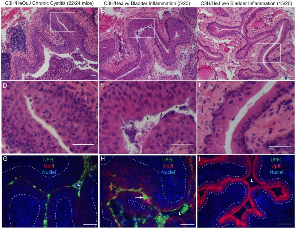 Chronic bladder infection in C3H/HeJ mice is histologically distinct from chronic cystitis in C3H/HeOuJ mice.
