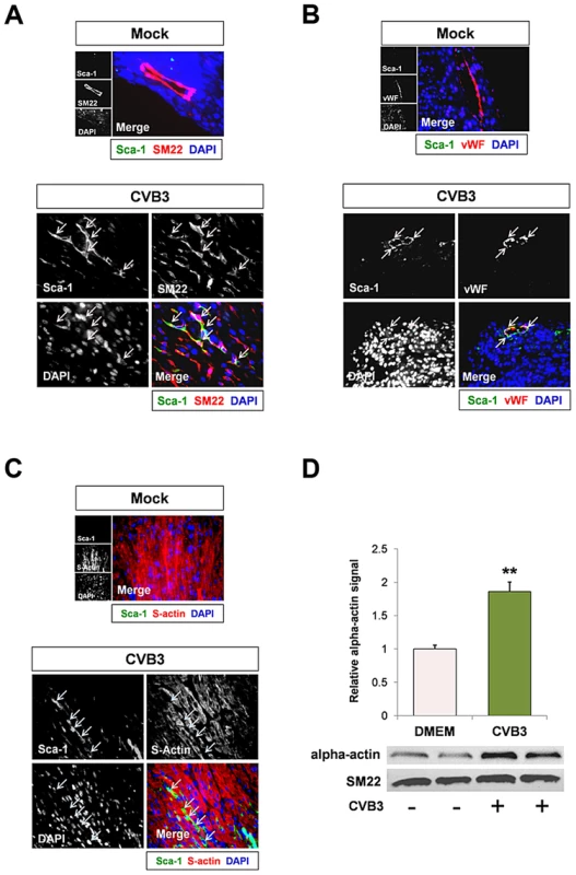 CVB3 induced premature differentiation of cardiac progenitor cells.
