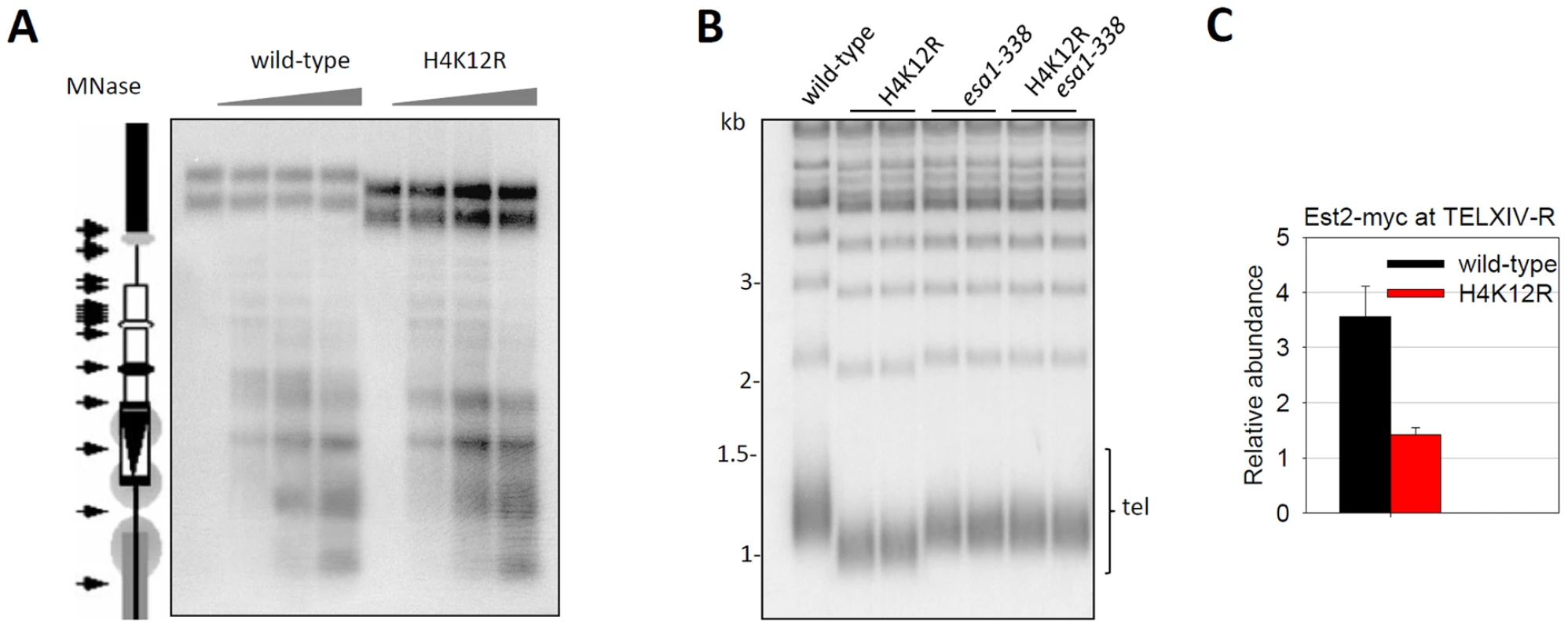 Histone H4K12 acetylation regulates telomere replication.