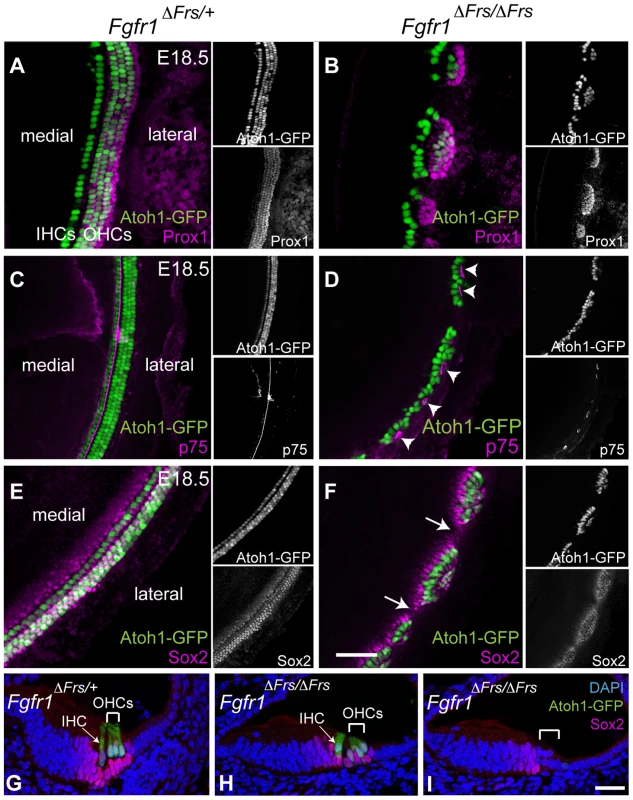Disruption of FGFR1-Frs2/3 pathway decreases the number of support cells.