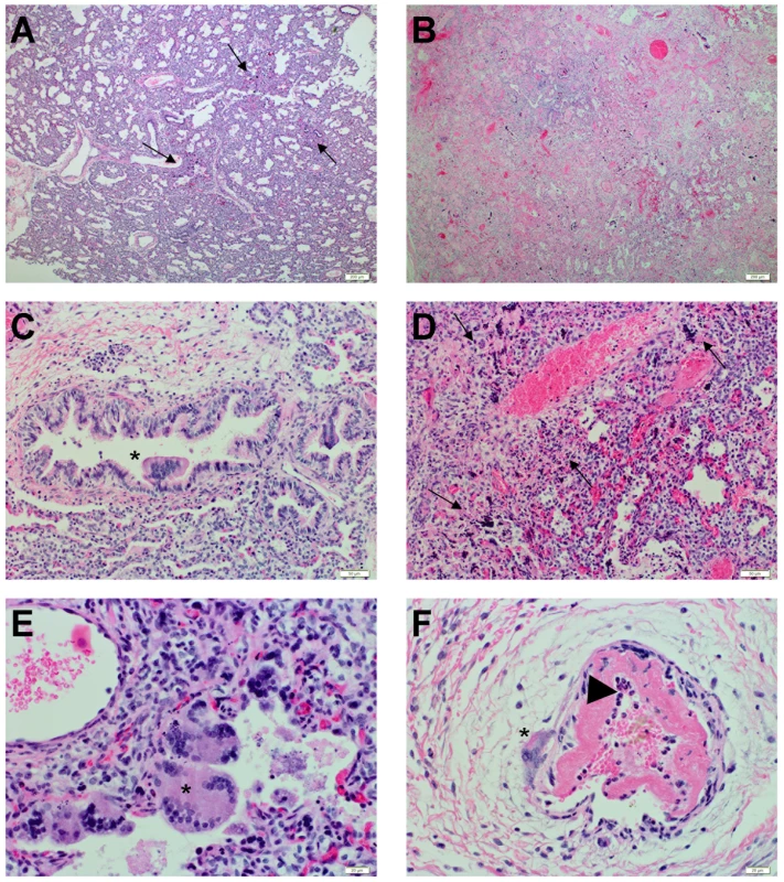 Histopathological changes during Nipah virus infection in human lung xenografts.