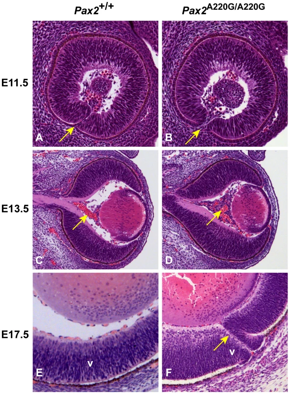 Histologic sections of <i>Pax2<sup>+/+</sup></i> and <i>Pax2<sup>A220G/A220G</sup></i> mouse eyes at three embryonic time points.