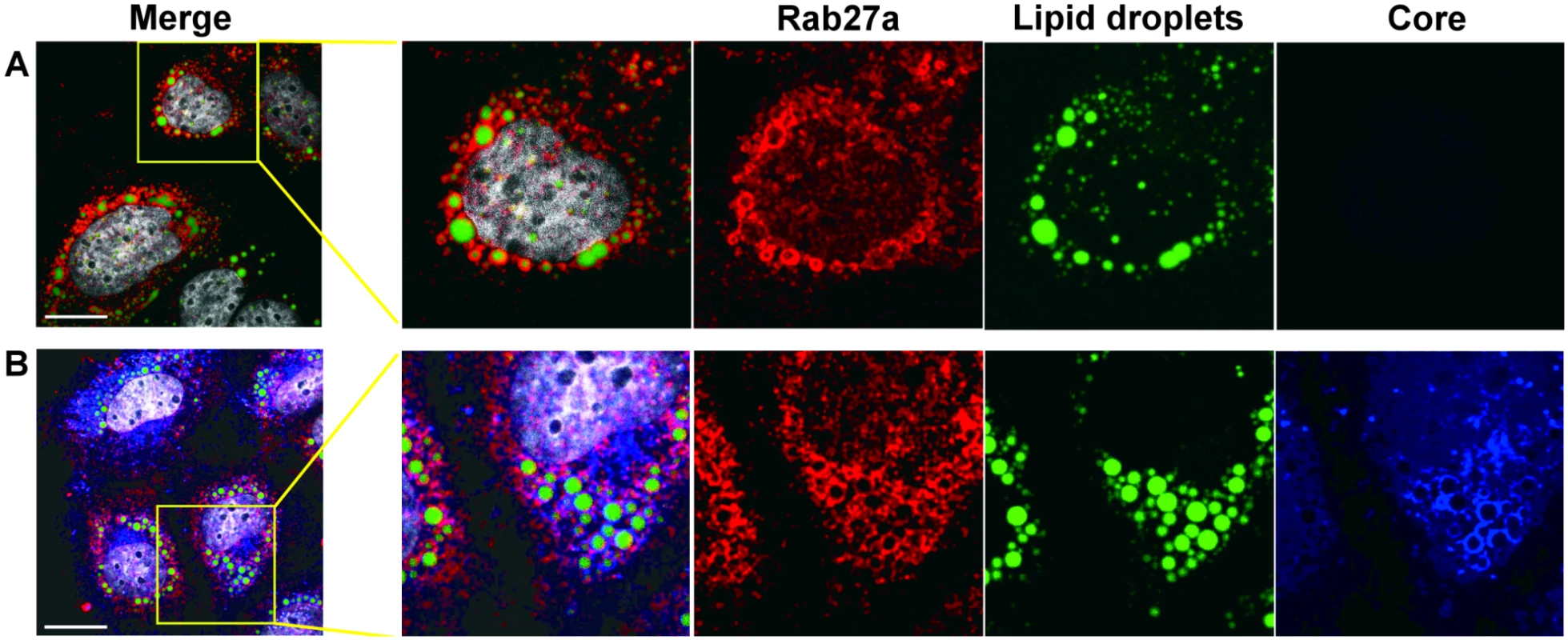 Subcellular localization of Rab27a.