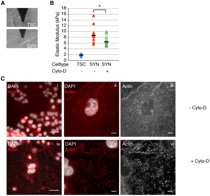 Actin cytoskeleton of murine syncytiotrophoblast (SYN) contributes to its elastic strength.