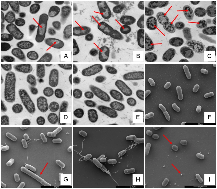 Electron microscopic analysis of <i>E. coli</i> response to AMP challenge.
