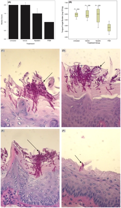 Efficacy of <i>Pichia</i> spent medium (PSM) in an experimental murine morel of oral candidiasis.