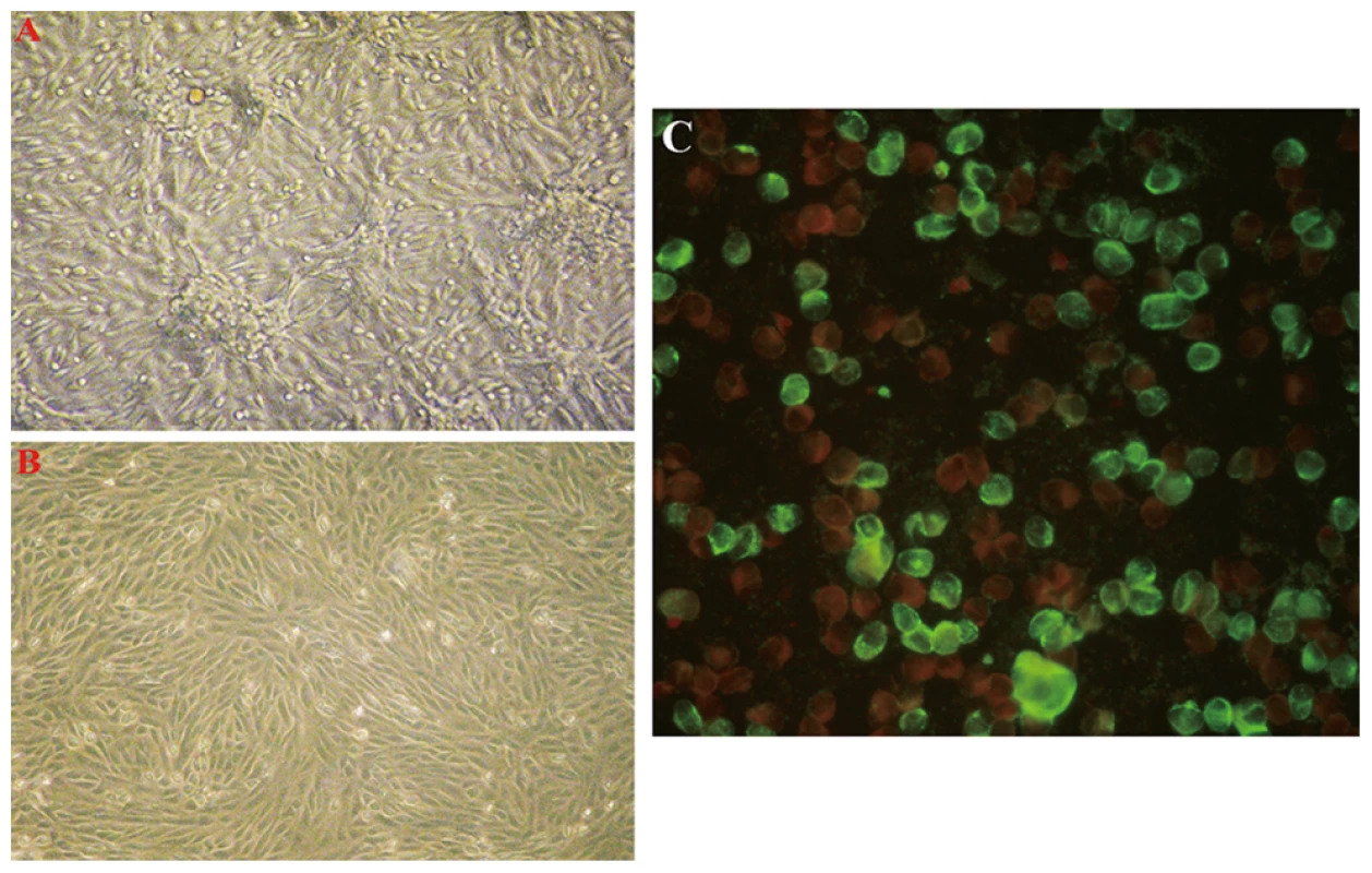 Vero E6 cells inoculated with acute serum specimens from patients with FTLS.