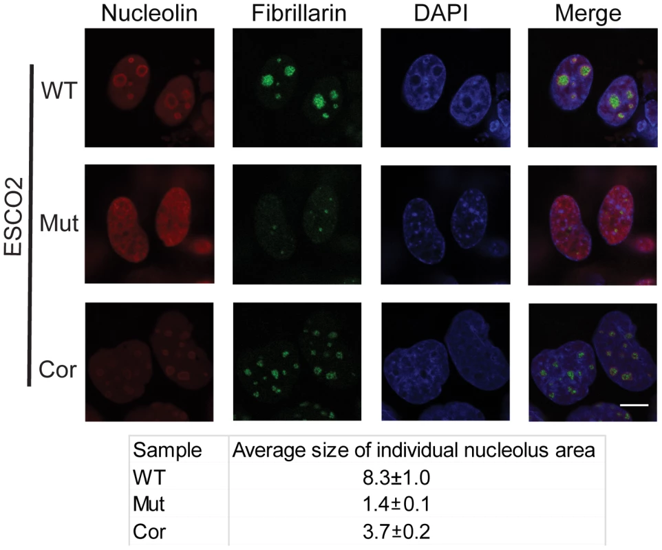 Nucleolar organization was severely disrupted in the immortalized RBS cells.