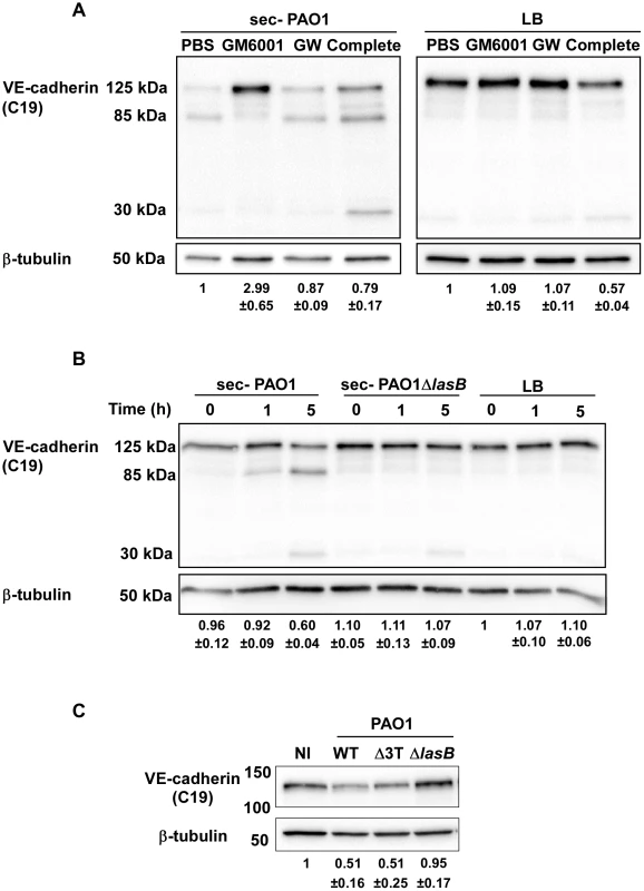 LasB protease is required for VE-cadherin cleavage.