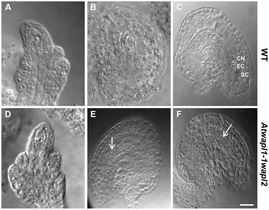 Female gametophyte development is altered in <i>Atwapl1-1wapl2</i> plants.