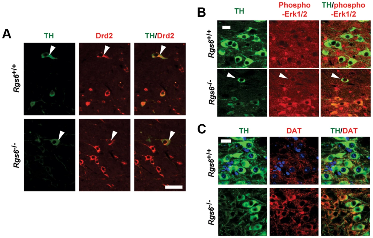 Drd2-related changes of gene expression in degenerating neurons of vSNc.