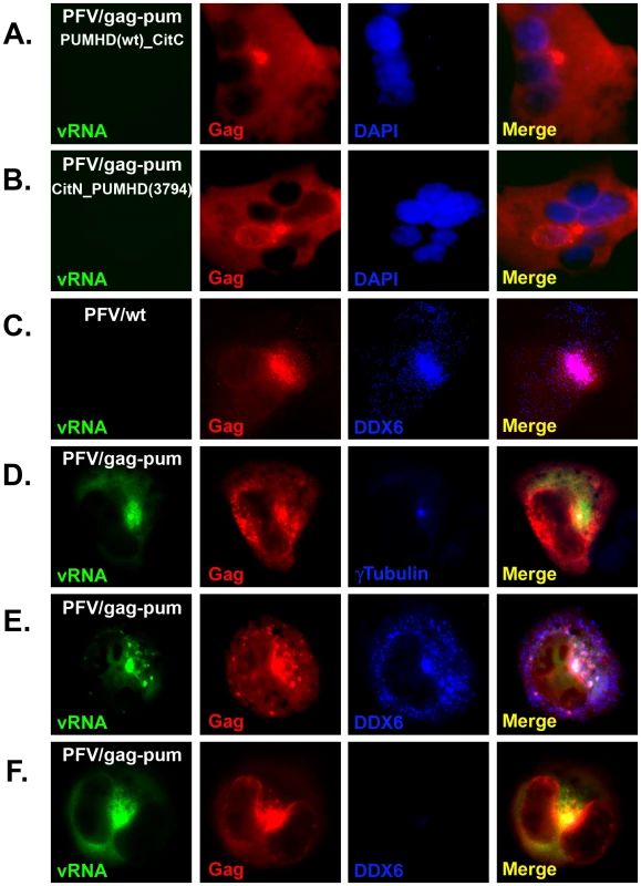 Co-localization of DDX6 with viral RNA and Gag near the MTOC.