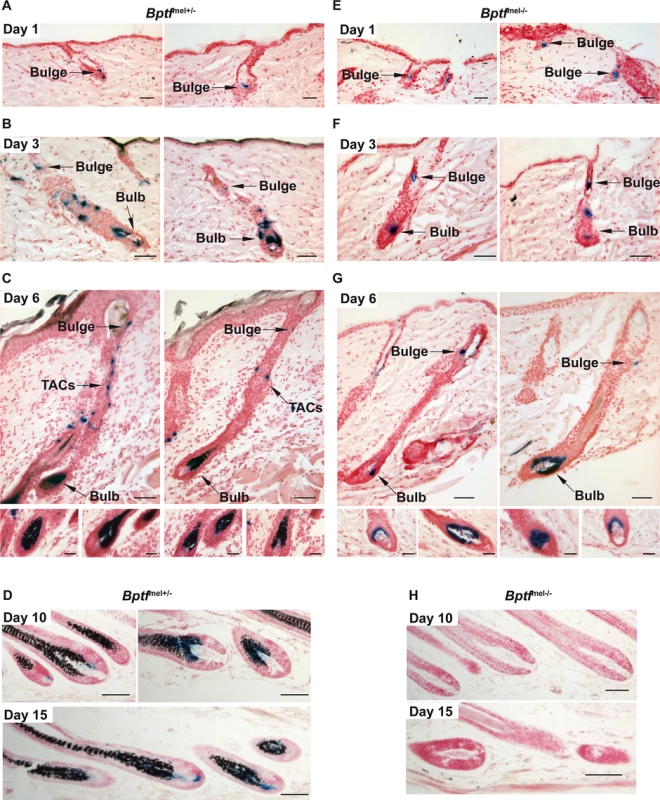 Bptf is required for proliferation and terminal differentiation of adult melanocytes.