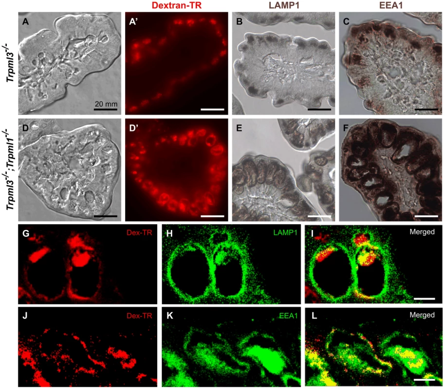The pathological vacuoles of suckling enterocytes lacking mucolipins 1 and 3 are aberrant hybrid organelles with endosomal and lysosomal components.