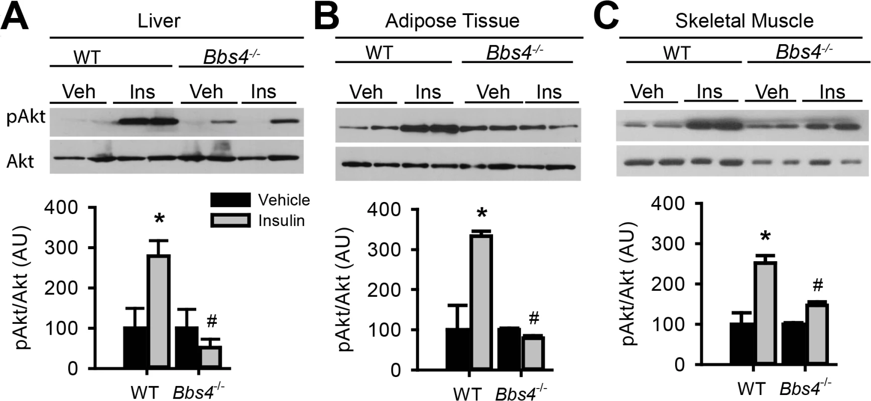 Obese Bbs4 null mice have reduced IR signaling (using phosphorylated Akt at S473 [pAkt] as readout), in liver (A), white adipose tissue (B) and skeletal muscle (C).