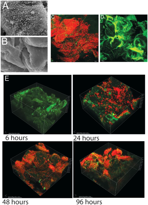 Biofilms of <i>Lactobacillus reuteri</i> 100-23 on the keratinized squamous stratified epithelium of the mouse forestomach.