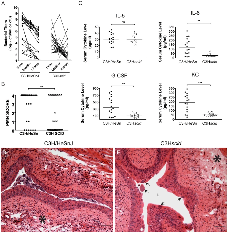 C3H background severe combined immunodeficient mice have muted acute inflammatory responses to UPEC infection and are resistant to chronic cystitis.