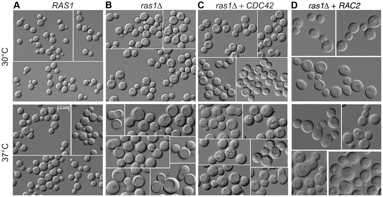 Yeast phase morphology of <i>C. neoformans</i> cells at 30 and 37°C after 4 hours.