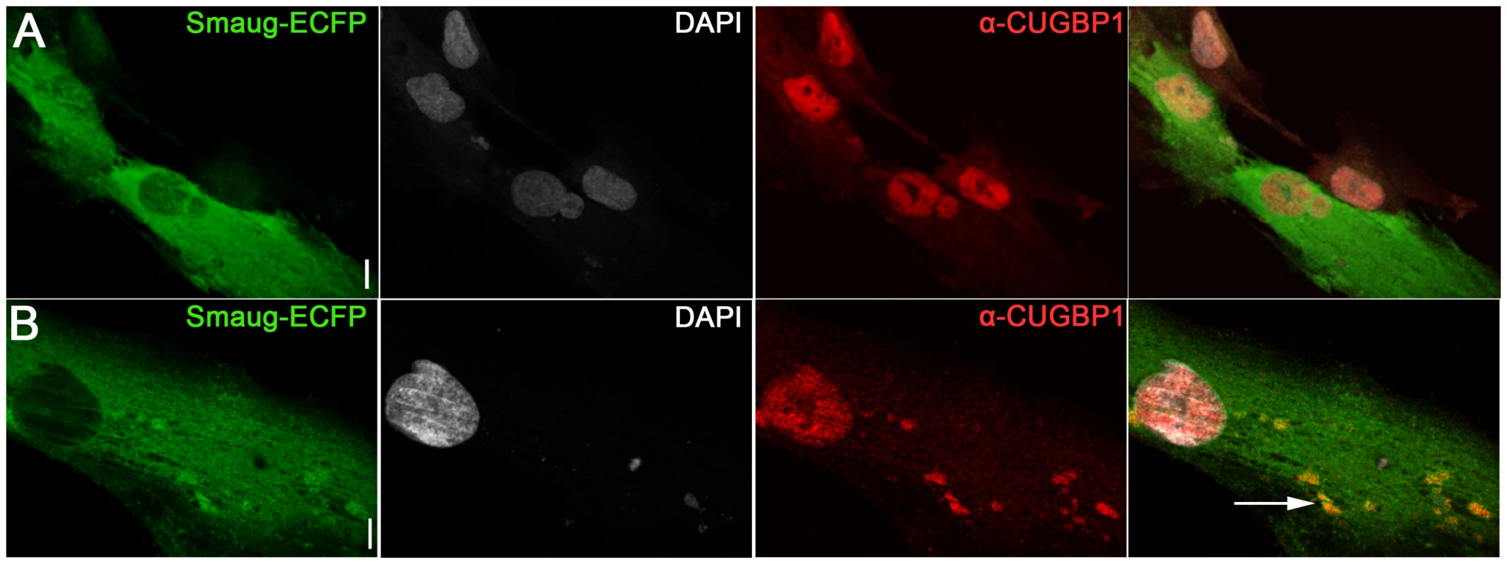Expression of SMAUG1 in control human myoblasts does not affect CUGBP1 nuclear localization.