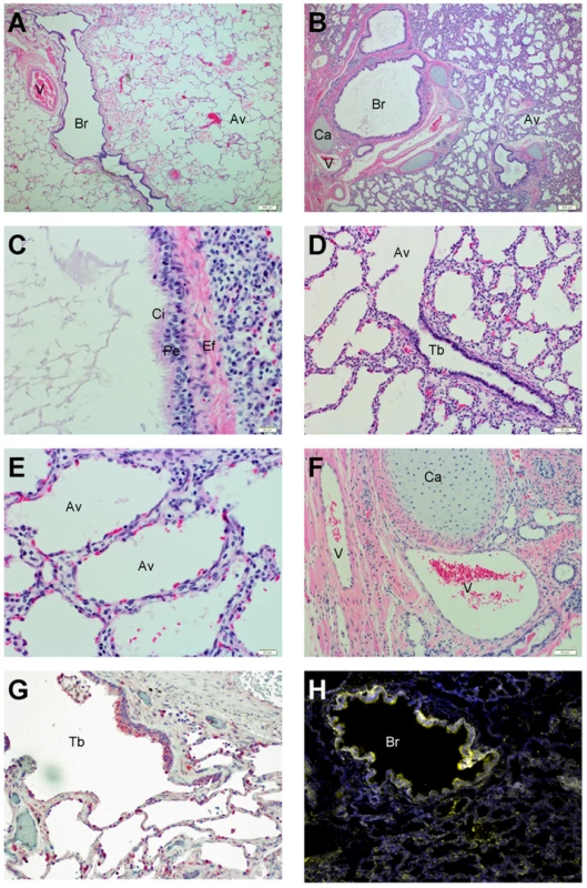 Histological characterization of human lung xenografts.