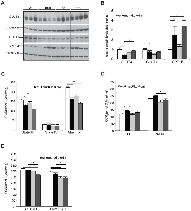 UCP2 promotes fatty acid oxidation in mtDNA mutator mitochondria.