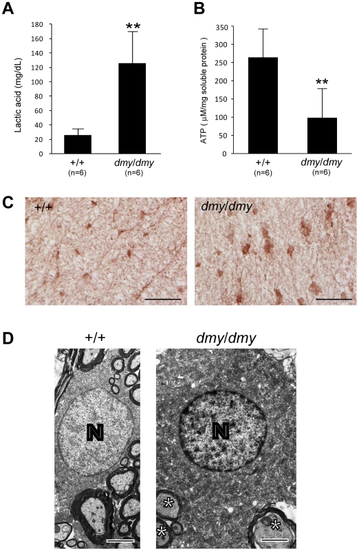 Biochemical and morphological abnormalities in the mitochondria of <i>dmy/dmy</i> mutant rats.