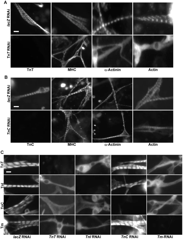 Tns-Tm complexes play an important role in sarcomere assembly.
