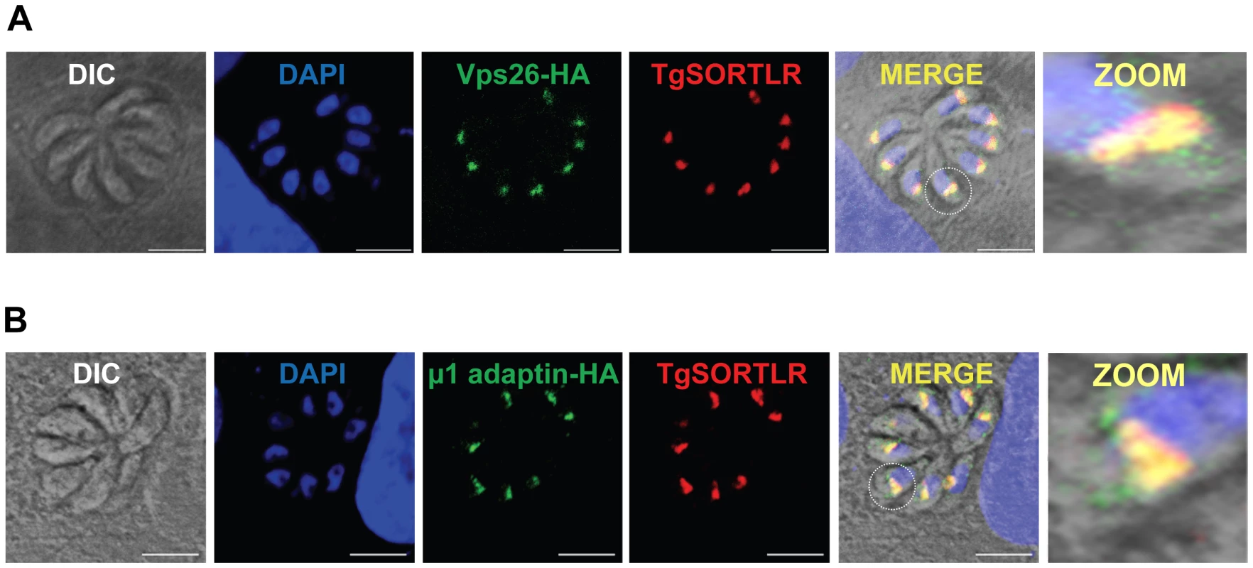TgSORTLR co-localizes with TgVsp26 and Tgμ1-adpatin.