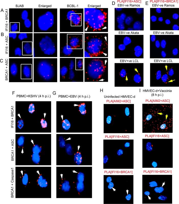 Analysis demonstrating that infection by nuclear DNA virus is essential for IFI16, ASC, BRCA1 and Caspase-1 associations and for BRCA1 association with IFI16 inflammasome components.