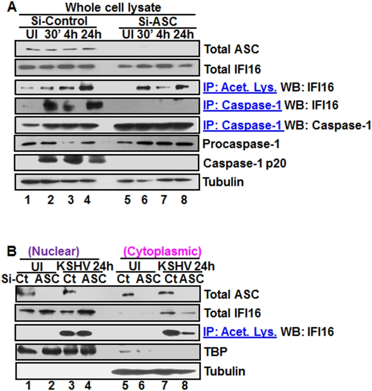 Effect of ASC knockdown on IFI16 acetylation and translocation.