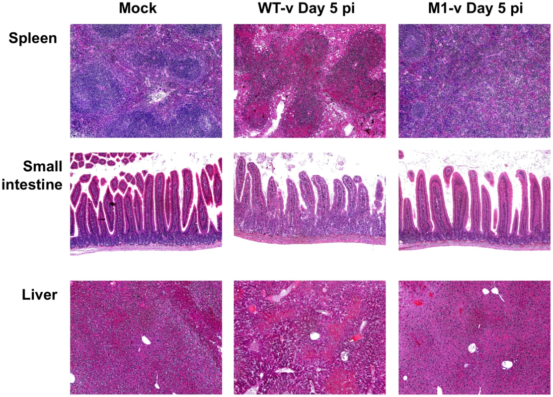 Pathology is markedly reduced in the absence of VF1 expression.