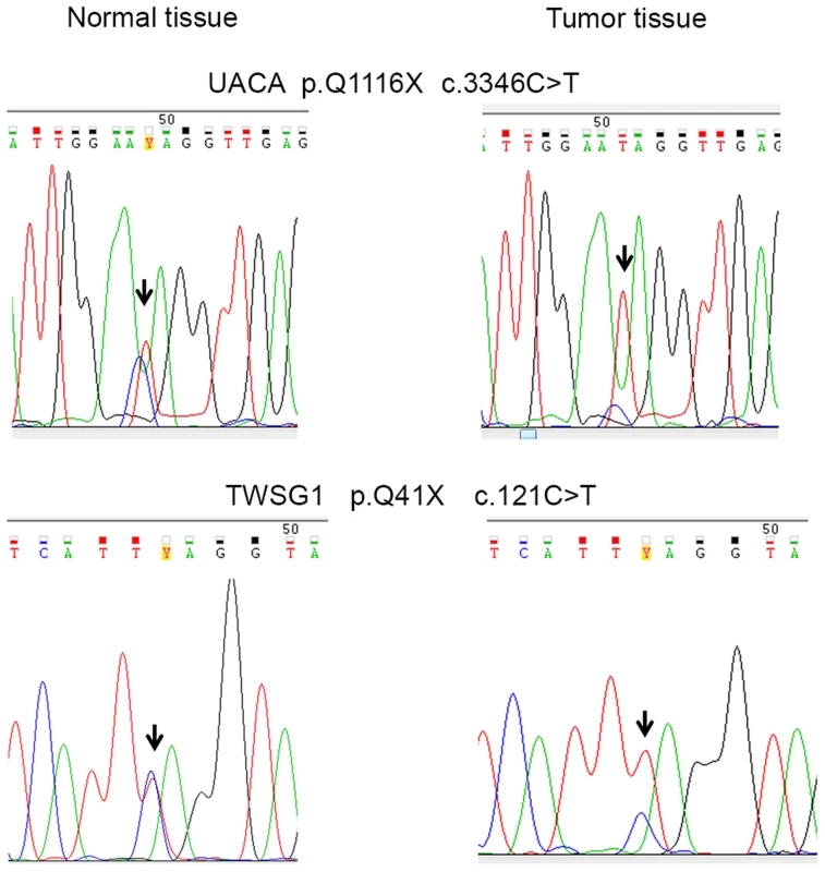 Examples of DNA sequence chromatograms.