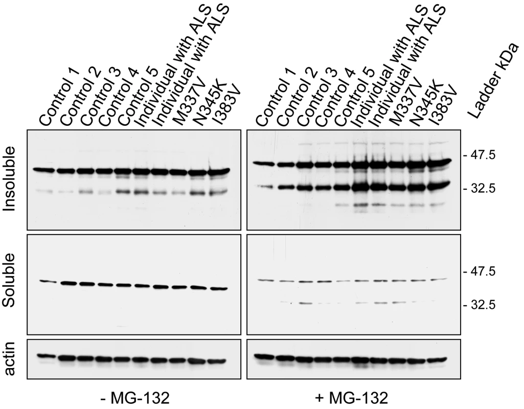 Biochemical analysis of TDP-43 in lymphoblastoid cell lines of <i>TARDBP</i> mutation carriers.