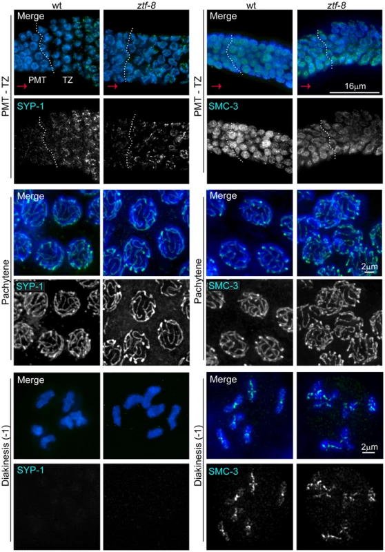 ZTF-8 is dispensable for axis morphogenesis and chromosome synapsis.