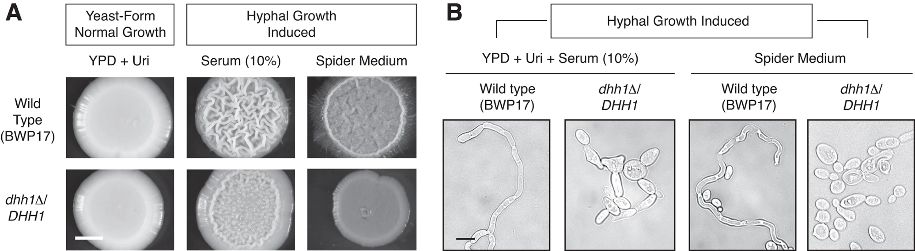 The P-body-localized mRNA decay gene <i>DHH1</i> is required for wild-type hyphal development in the opportunistic human fungal pathogen <i>Candida albicans</i>.