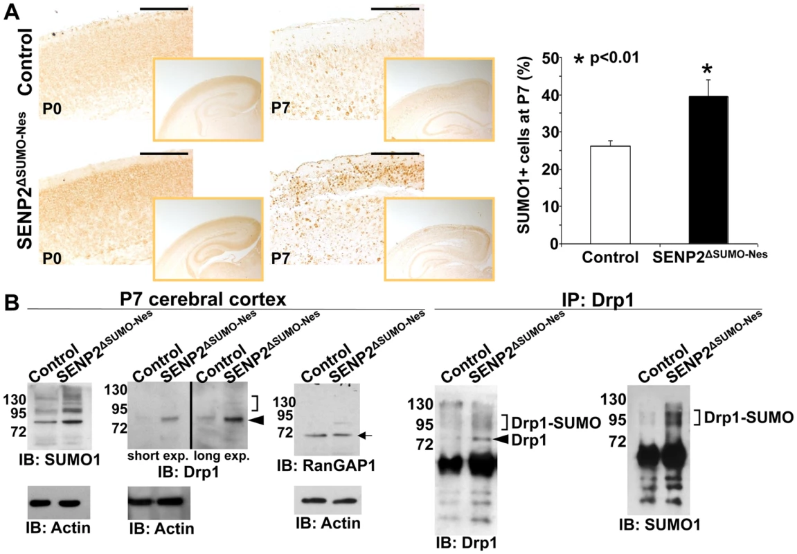 SENP2 deficiency enhances Drp1 sumoylation and stabilization in the developing cerebral cortex.
