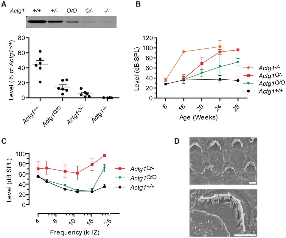 Onset and progression of hearing loss depends on γ-actin concentration.